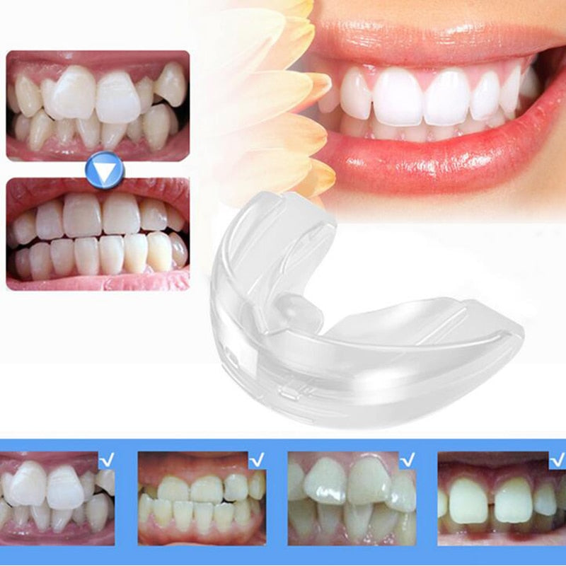 Alinhador de Dentes.
