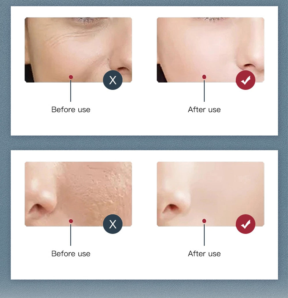 Máscara facial de LED de 7 cores terapia de luz PDT