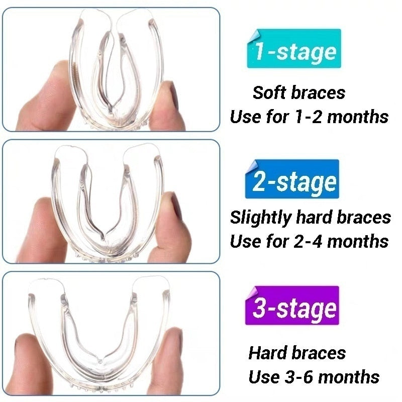 Alinhador de Dentes.